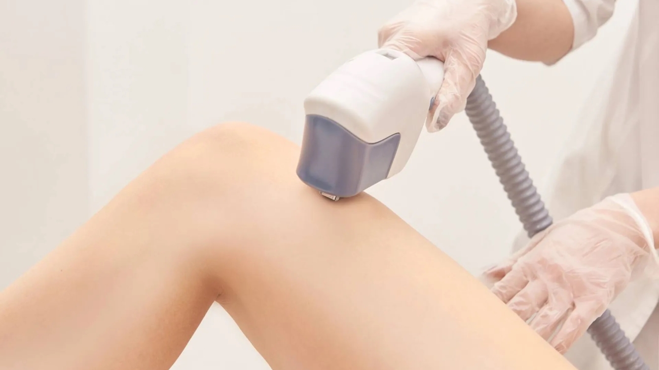 marina-conese-dermatologa-epilazione