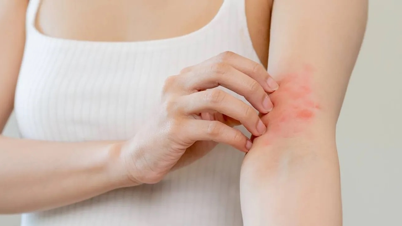 dermatologia-acne-eczema-psoriasi-trattamenti-dermatologici-pelle-marina-conese